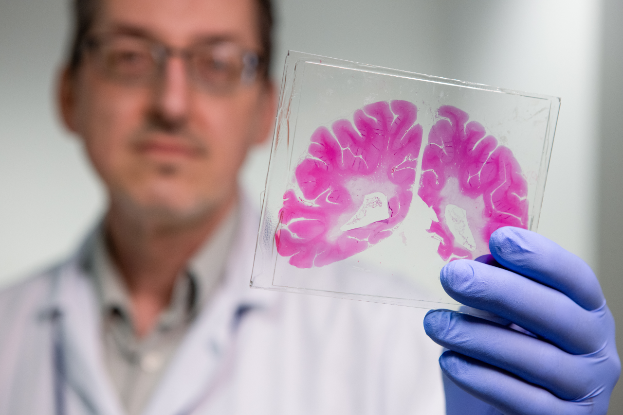 Researcher holding up a slide with a brain scan image