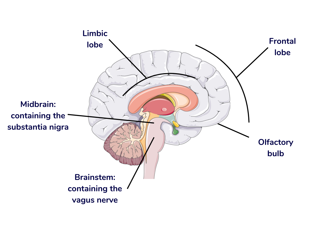 What areas of the brain are affected in Parkinson's? | Parkinson's UK